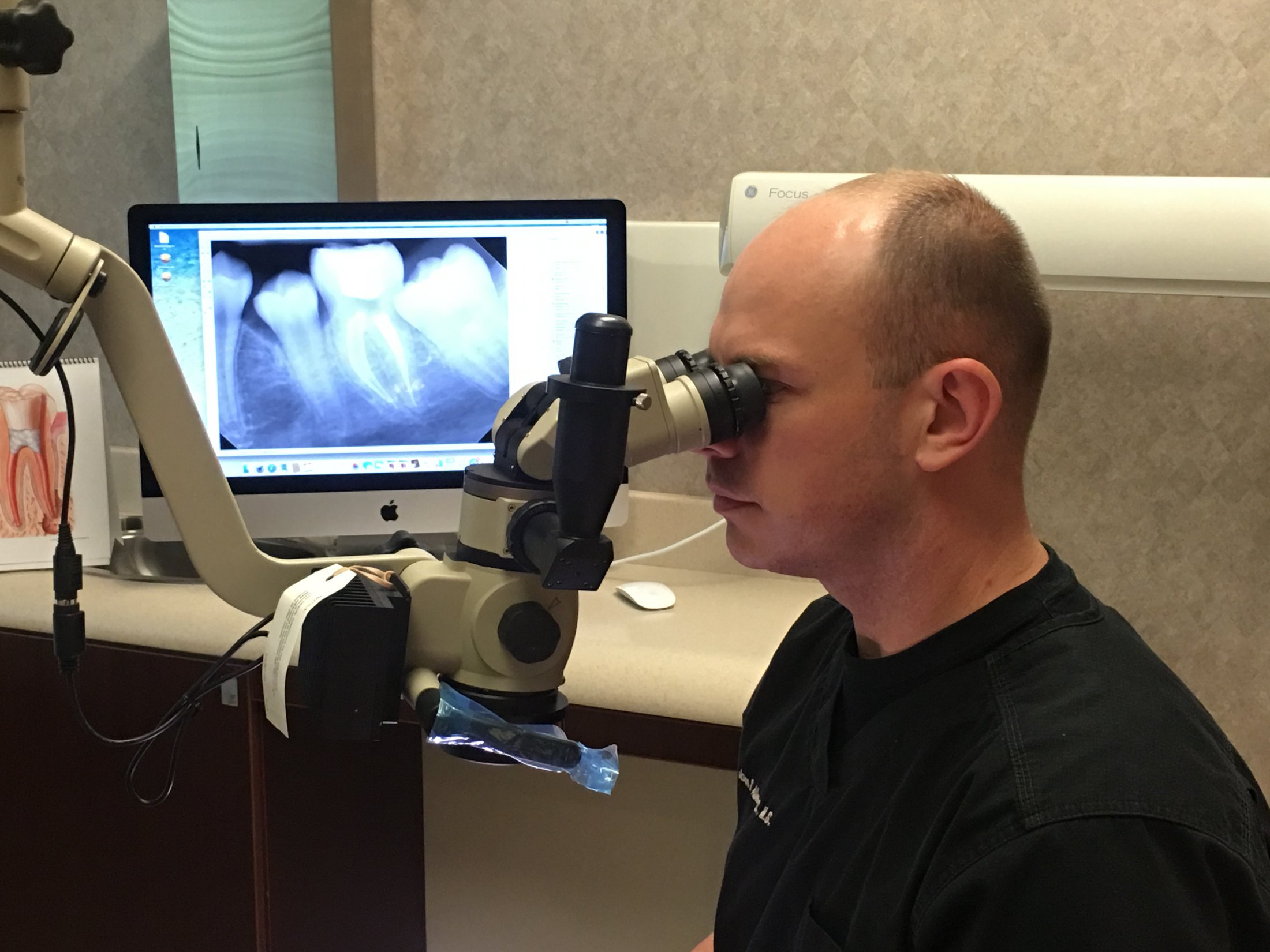 Endodontist Jacksonville FL Endodontics of Mandarin Root Canal